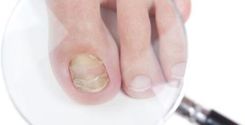 Onddoen diagnostikoa