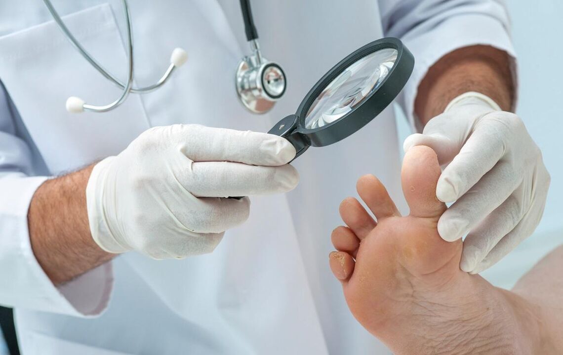 medikuak iltzeak aztertzen ditu onddoen bila